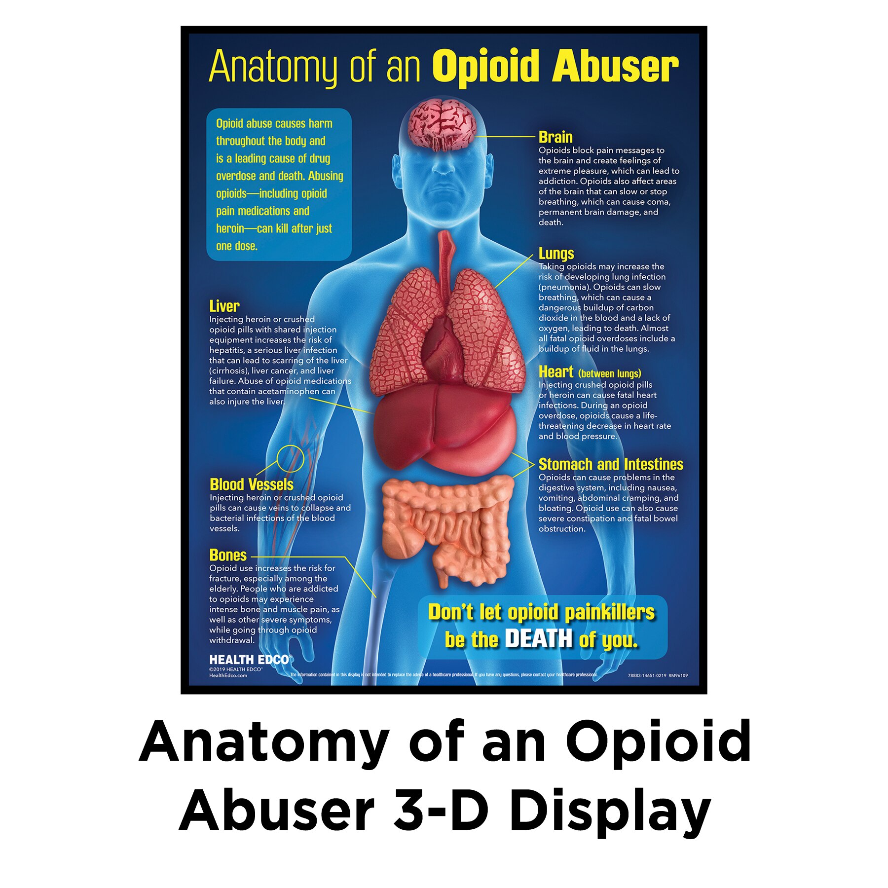 Anatomy of an Opioid Abuser 3-D health education display, opioid drug education materials and models, Health Edco, 78883